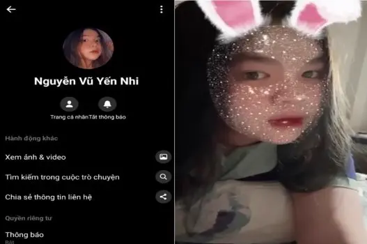 Ảnh thumbnail video Chân của Nguyễn Vũ Yến Nhi bị đụ hai hàng